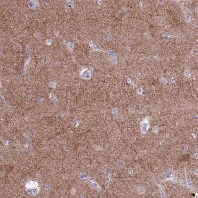Immunohistochemistry-Paraffin: PDE10A Antibody [NBP2-48869]