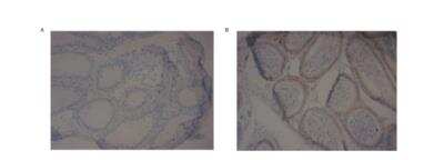 Immunohistochemistry-Paraffin: PDE10A Antibody [NB300-645]