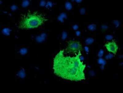 Immunocytochemistry/ Immunofluorescence: PDE1B Antibody (OTI6E4) - Azide and BSA Free [NBP2-73278]