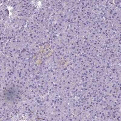 Immunohistochemistry-Paraffin: PDE2A Antibody [NBP2-48608]