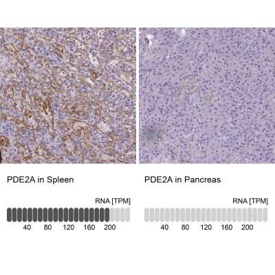 Immunohistochemistry-Paraffin: PDE2A Antibody [NBP2-48608]