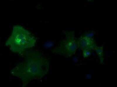 Immunocytochemistry/ Immunofluorescence: PDE2A Antibody (OTI3A4) - Azide and BSA Free [NBP2-73288]