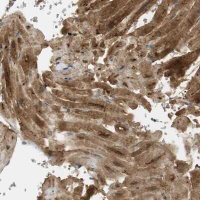 Immunohistochemistry-Paraffin: PDE3A Antibody [NBP1-85645]