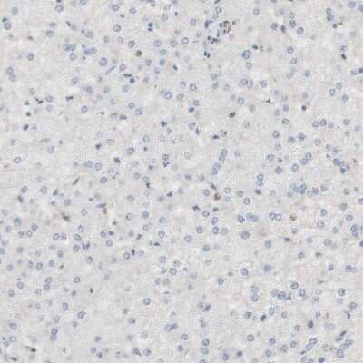 Immunohistochemistry-Paraffin: PDE3A Antibody [NBP1-85645]