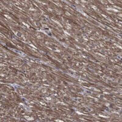 Immunohistochemistry-Paraffin: PDE3A Antibody [NBP3-17664]