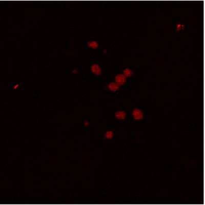 Immunocytochemistry/ Immunofluorescence: PDE3B Antibody [NBP3-12242]