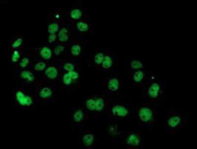 Immunocytochemistry/ Immunofluorescence: PDE4B Antibody (OTI1D12) [NBP2-01171]