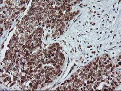 Immunohistochemistry-Paraffin: PDE4B Antibody (OTI1D12) [NBP2-01171]