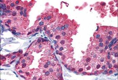 Immunohistochemistry-Paraffin: PDE4B Antibody [NB100-2562]