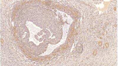 Immunohistochemistry-Paraffin: PDE4B Antibody [NBP3-12243]
