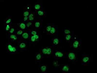 Immunocytochemistry/ Immunofluorescence: PDE4B Antibody (OTI1D12) - Azide and BSA Free [NBP2-73292]