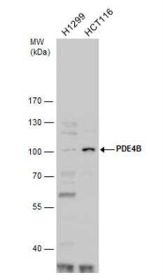 Western Blot: PDE4B Antibody [NBP1-33637]
