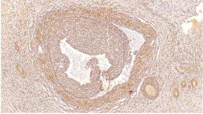 Immunohistochemistry-Paraffin: PDE4C Antibody [NBP3-12244]