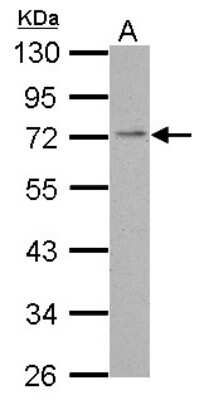 Western Blot: PDE4C Antibody [NBP2-19746]
