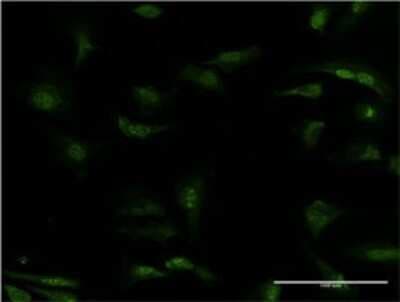 Immunocytochemistry/ Immunofluorescence: PDE5A Antibody (1F11) [H00008654-M02]