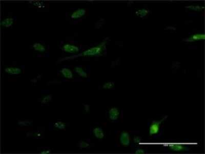 Immunocytochemistry/ Immunofluorescence: PDE5A Antibody (9H5) [H00008654-M01]
