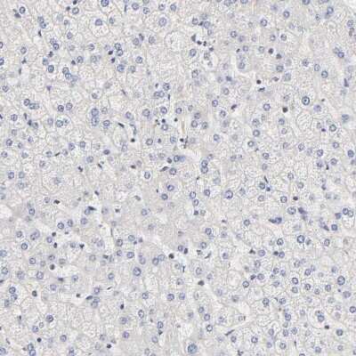 Immunohistochemistry-Paraffin: PDE5A Antibody [NBP1-86139]