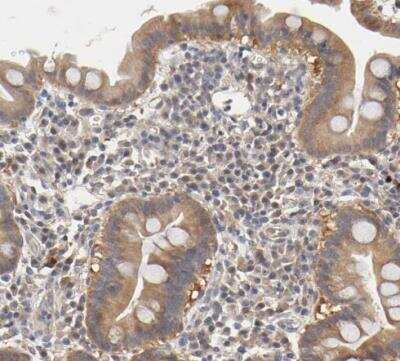 Immunohistochemistry-Paraffin: PDE5A Antibody [NBP1-86139]