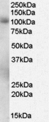 Western Blot: PDE5A Antibody [NB300-957]
