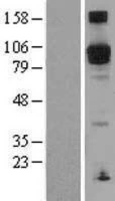 Western Blot: PDE5A Overexpression Lysate [NBL1-14225]