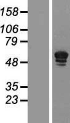 Western Blot: PDE5A Overexpression Lysate [NBP2-08426]