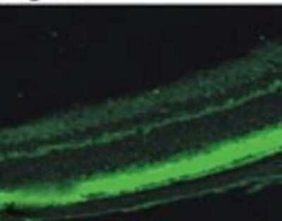 Immunocytochemistry/ Immunofluorescence: PDE6 beta Antibody [NB120-5663]