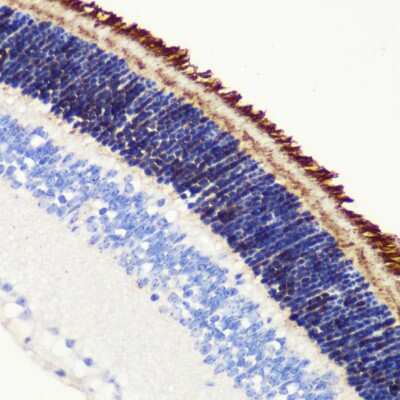 Immunohistochemistry-Paraffin: PDE6 beta Antibody - BSA Free [NBP2-95225]