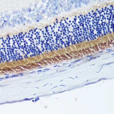Immunohistochemistry-Paraffin: PDE6 beta Antibody - BSA Free [NBP2-95225]