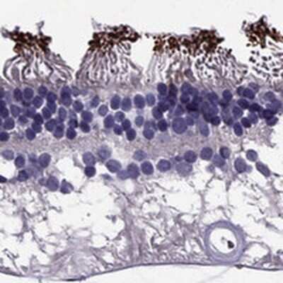 Immunohistochemistry: PDE6A Antibody [NBP2-68985]