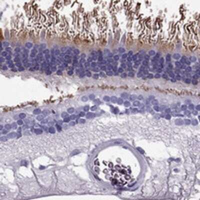 Immunohistochemistry-Paraffin: PDE6A Antibody [NBP1-87312]