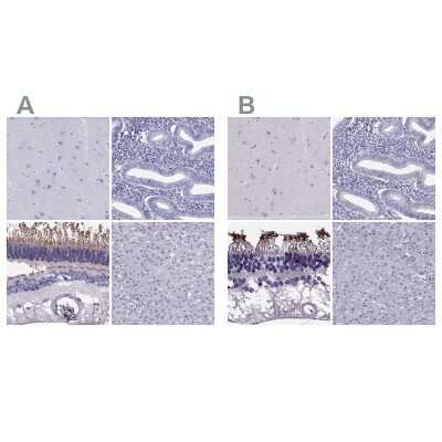Immunohistochemistry-Paraffin: PDE6A Antibody [NBP1-87312]