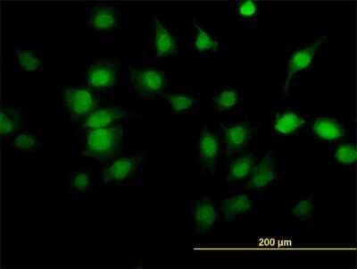 Immunocytochemistry/ Immunofluorescence: PDE6D Antibody (5C7) [H00005147-M06]