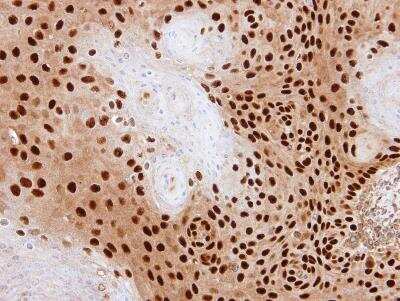 Immunohistochemistry-Paraffin: PDE6D Antibody [NBP1-32730]