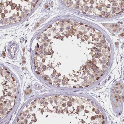 Immunohistochemistry-Paraffin: PDE6D Antibody [NBP1-86275]