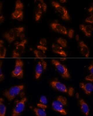 Immunocytochemistry/ Immunofluorescence: PDE6G Antibody - Azide and BSA Free [NBP2-93029]