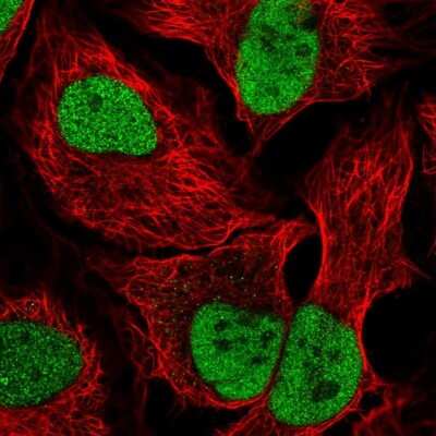 Immunocytochemistry/ Immunofluorescence: PDE7B Antibody [NBP1-85987]