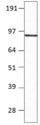Western Blot: PDE7B Antibody [NBP3-12246]