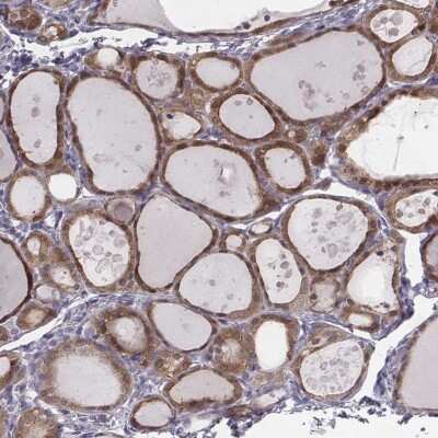 Immunohistochemistry-Paraffin: PDE8B Antibody [NBP1-86280]