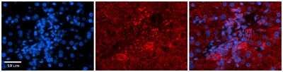 Immunohistochemistry: PDGF-B Antibody [NBP1-58279]