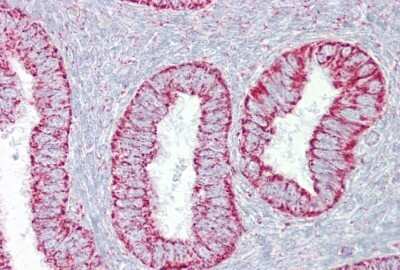 Immunohistochemistry-Paraffin: PDGF-B Antibody [NBP1-58279]