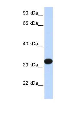 Western Blot: PDGF-B Antibody [NBP1-58279]