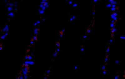Immunocytochemistry/ Immunofluorescence: PDGFR alpha Antibody (8E12F2) - BSA Free [NBP2-52528]