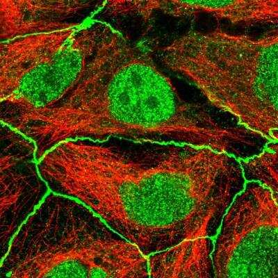 Immunocytochemistry/ Immunofluorescence: PDGFR alpha Antibody [NBP2-76508]