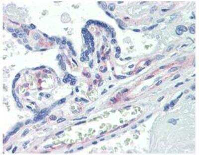Immunohistochemistry-Paraffin: PDGF R beta Antibody (42G12) [NBP1-19191]
