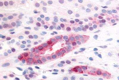 Immunohistochemistry-Paraffin: PDGF R beta Antibody [NBP3-11723]