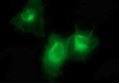 Immunocytochemistry/ Immunofluorescence: PDGF R beta Antibody (OTI1E8) - Azide and BSA Free [NBP2-73304]