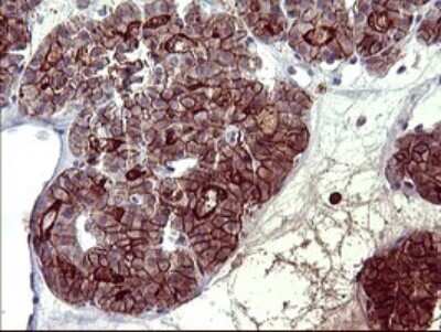 Immunohistochemistry: PDGF R beta Antibody (OTI1E8) [NBP2-46361]