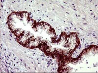 Immunohistochemistry: PDGF R beta Antibody (OTI1E8) [NBP2-46361]