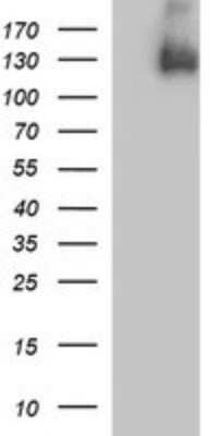 Western Blot: PDGF R beta Antibody (OTI1E8) [NBP2-46361]