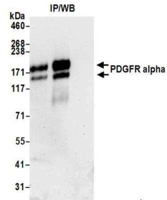 Immunoprecipitation: PDGFR alpha Antibody (BLR078G) [NBP3-14686]